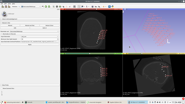ElectrodesToMarkups module for selecting electrodes within 3D Slicer.