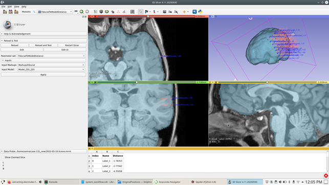 "fiducialtomodeldistance" module for selecting projected electrodelocations on an undeformed brain surface with reference to originalelectrode locations within 3D Slicer.