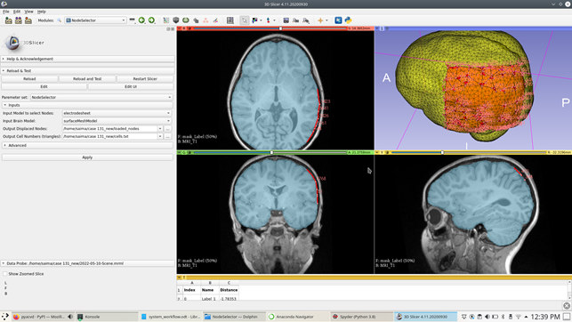 "NodeSelector" module for selecting nodes on undeformed brainsurface under electrode sheet model within 3D Slicer.