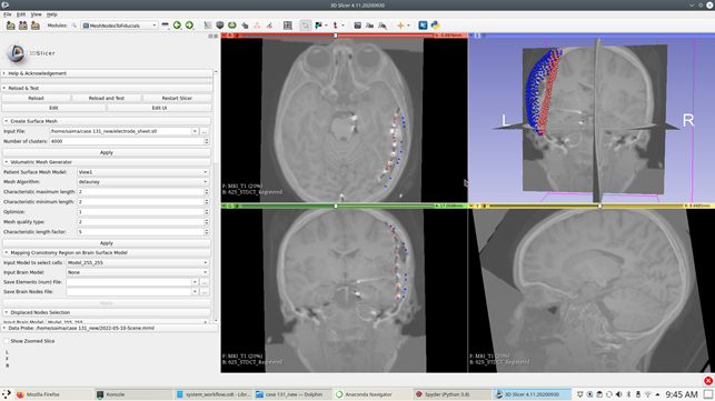 Undeformed brain surface nodes (blue) and deformed brain surface nodes(red) after applying the scattered transform.