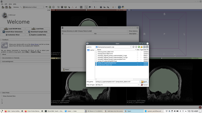 Loading data within 3D Slicer.