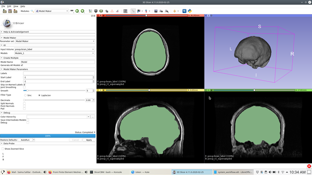 Surface model generation within 3D Slicer.