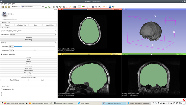 Surface Toolbox module within 3DSlicer.