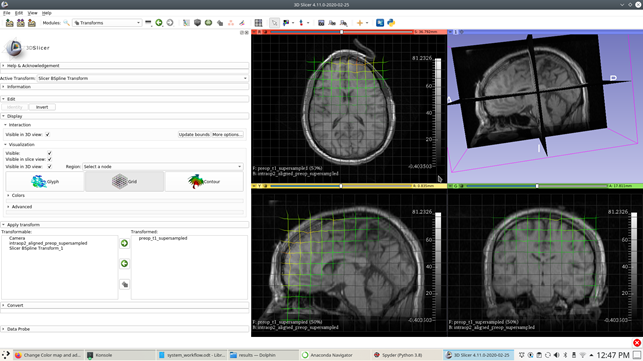 Transform module within 3D Slicer.