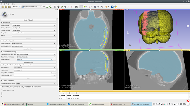 Displacement loading calculation based on undeformed and deformedbrain surface nodes (seeFig. fig:electrodes_8{reference-type="ref"reference="fig:electrodes_8"})